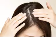 薄毛・AGA治療