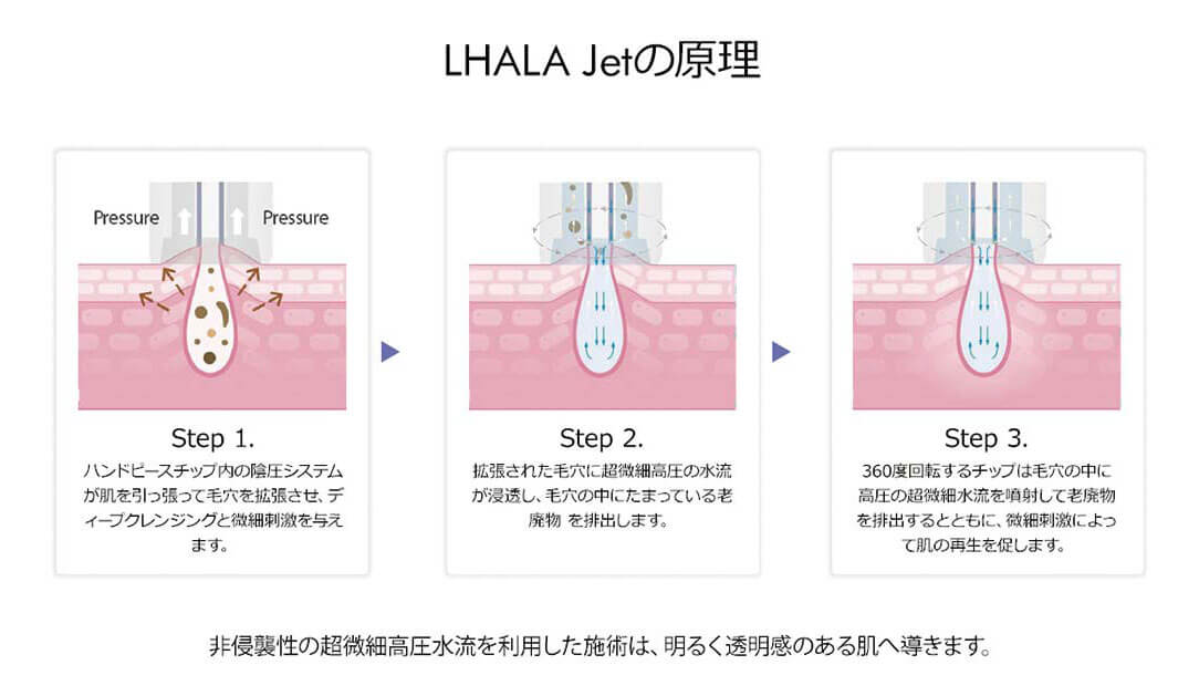 LHALA Jetの原理
