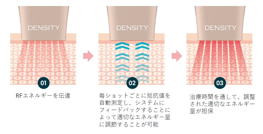 痛みを軽減する強力なクーリング